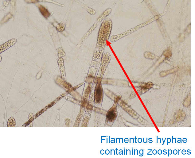 spores-in-sporangium saprolegnia